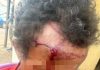 PM prende homem após agressão com pedaço de madeira em Porangatu
