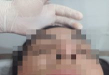 PM prende homem após agressão contra ex-companheira